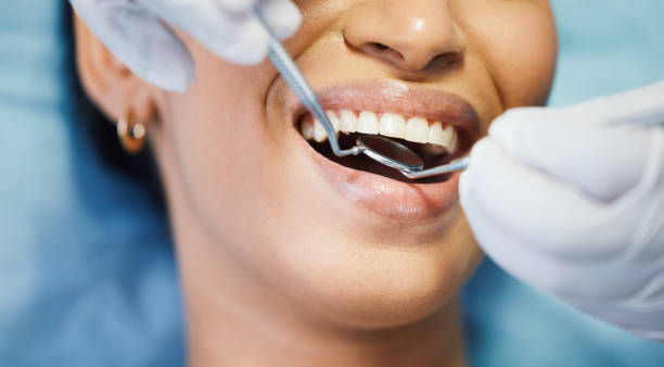 Best Emergency Dental Care for Broken or Chipped Teeth in Merrifield, VA