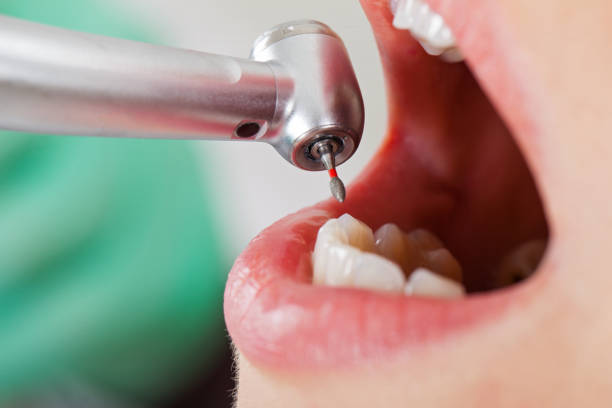 Best Emergency Denture Repair in Merrifield, VA